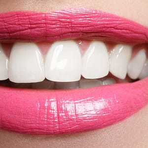 Dental Check-Up Dubai