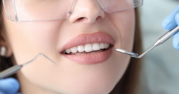 Choice Of Dental Treatment At Saphire Dent Dubai Dubai - Image 3