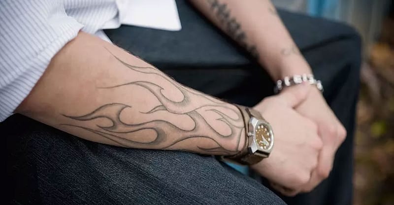 Three Sessions Of Laser Tattoo Removal: Small